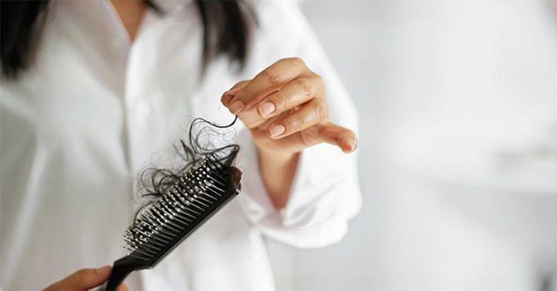دلایل رایج ریزش مو در زنان