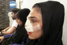 تیغ هایی که بی دلیل بر روی صورت کشیده می شوند/ چرا عمل های زیبایی در جامعه ایرانی افزایش یافت؟