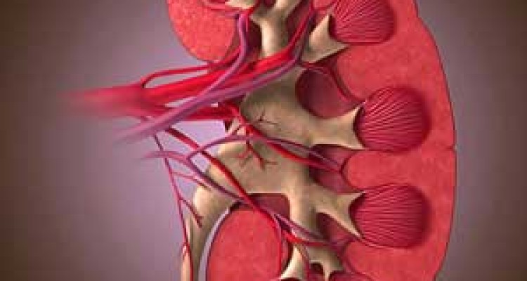 علایم سرطان کلیه را بشناسید