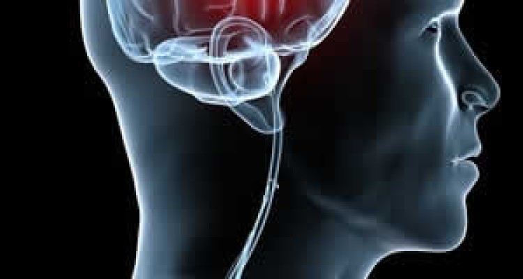  راههایی ساده برای پیشگیری از سکته مغزی  راههایی ساده برای پیشگیری از سکته مغزی 