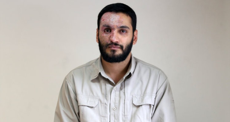 همه می‌توانند شهید شوند/ هرکدام از زخم‌های جانبازی‌ام نشانه‌ است