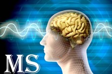 بیماری ام اس درمان شد
