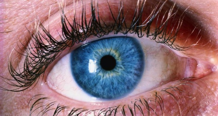  علت بروز و درمان دانه‌های چربی سفید رنگ زیر چشم 