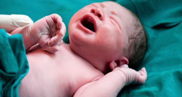 ترس از درد زایمان علت گرایش زنان ایرانی به سزارین