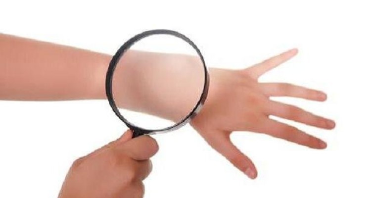برای جذب ویتامین D خود را در معرض آفتاب قرار ندهید