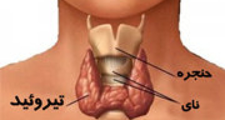  ارتباط بیماری تیروئید با ناباروری