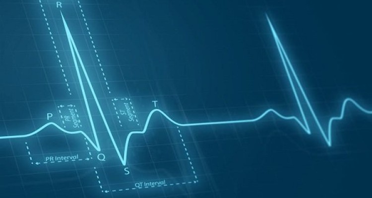 ۴۵ درصد مرگ ها در کرمانشاه به دلیل بیماری قلبی است