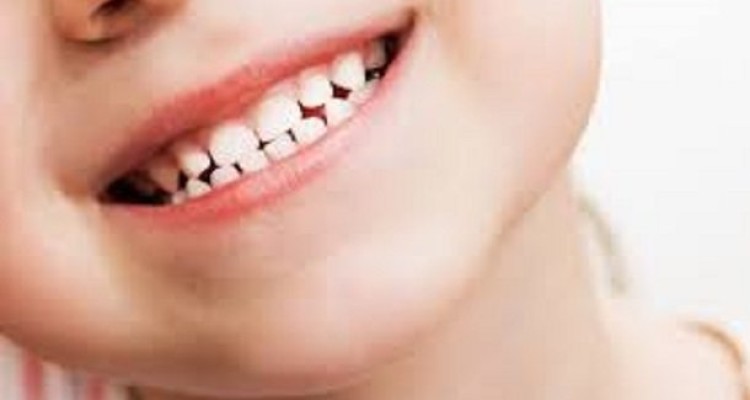 نکاتی که والدین باید در مورد دندان های شیری کودکان بدانند