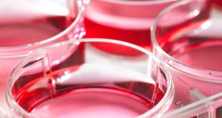 درمان ضایعات کبدی با سلول بنیادی توسط محققان کشور