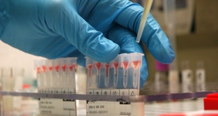 راه اندازی مرکز جامع سلول بنیادی در یزد و خوزستان