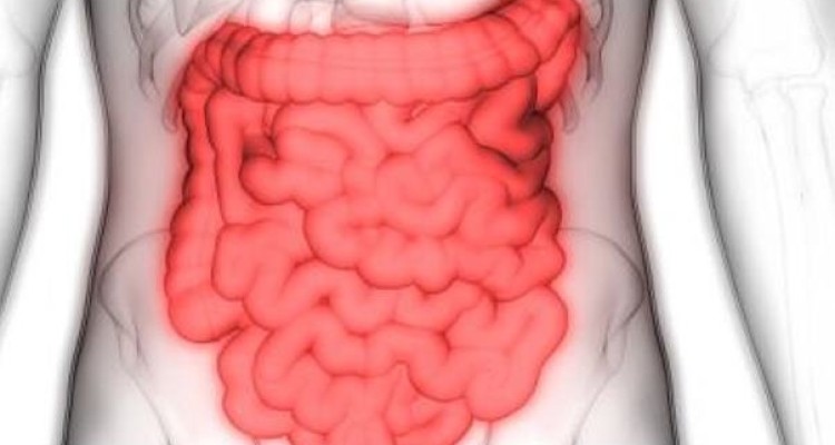 فروکتوز موجب تشدید بیماری التهاب روده می شود