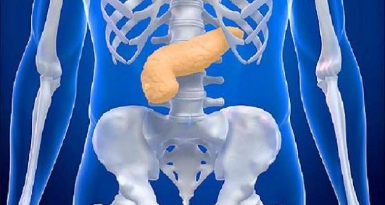 تاثیر جراحی کاهش وزن در پایین آمدن ریسک سرطان لوزالمعده