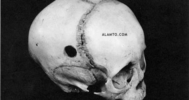 عجیب ترین جمجمه های جهان + عکس