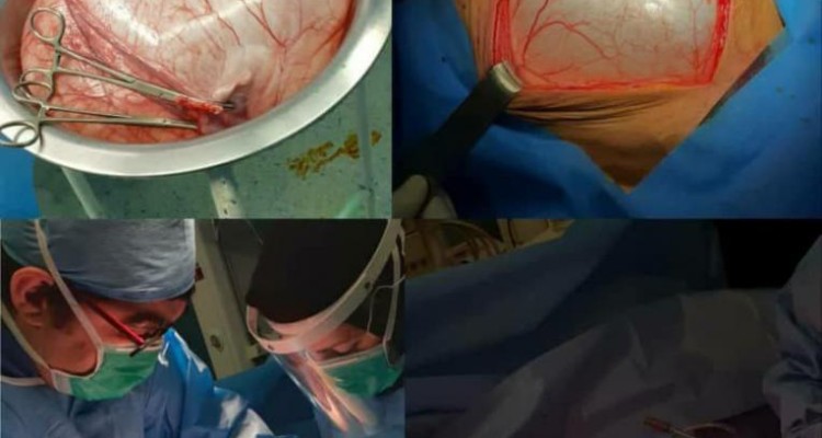 خارج کردن توده ۱۵ کیلوگرمی از شکم بیمار در بیمارستان دکتر معاون صحنه + تصویر