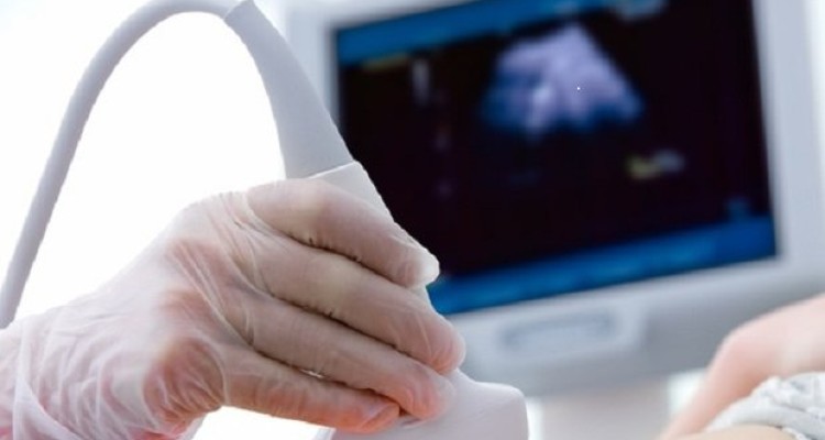 علل بروز سرطان دهانه رحم/خطر ازدواج قبل از ۱۶ سالگی