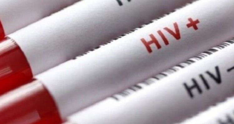 موفقیت ۹۷ درصدی درمان ایدز در کرمانشاه