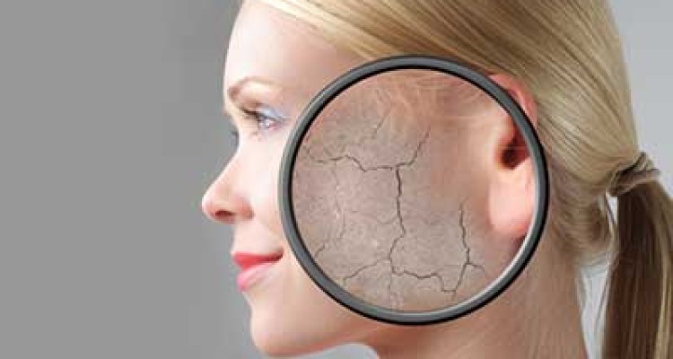 علت خشکی پوست و راههای مقابله با آن
