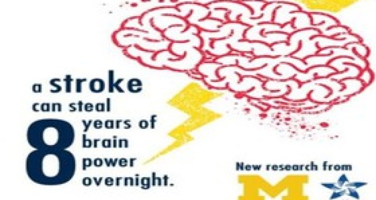 سکته، مغز را یک شبه هشت سال پیرتر می‌کند 