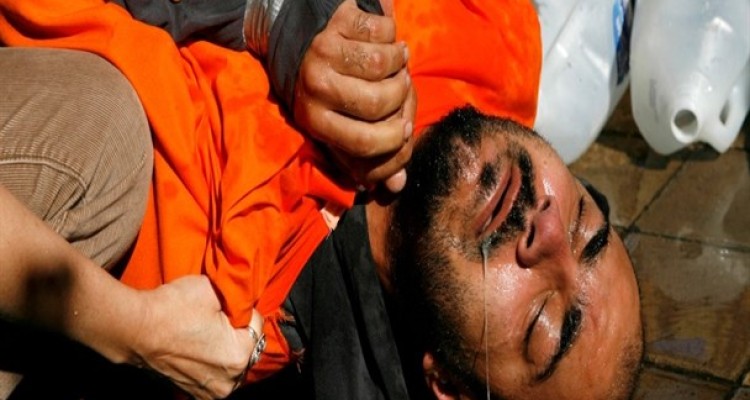 انجام آزمایشات پزشکی روی زندانیان با مجوزسازمان اطلاعات مرکزی آمریکا