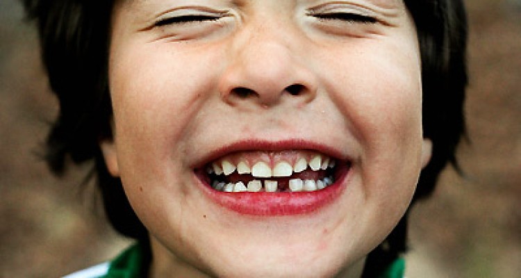  مشکل های رایج رویش دندان های دائمی در کودکان 