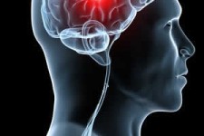  راههایی ساده برای پیشگیری از سکته مغزی  راههایی ساده برای پیشگیری از سکته مغزی 