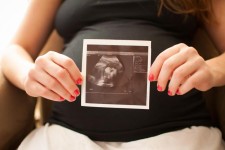  در بارداری چند بار سونوگرافی لازم است؟ 