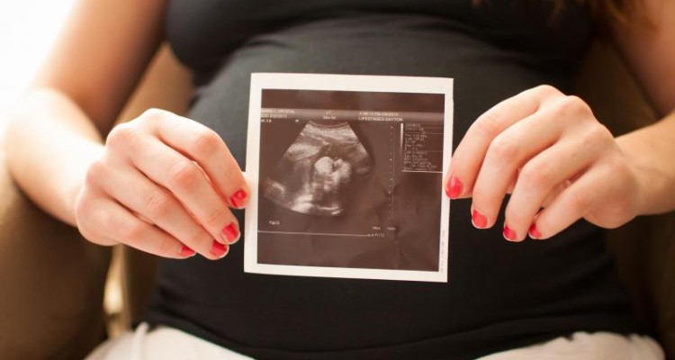  در بارداری چند بار سونوگرافی لازم است؟ 