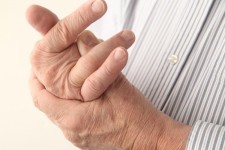  7 نکته که در مورد آرتروز نمی‌دانید 