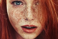  نسخه‌هایی برای خلاصی از کک و مک پوستی 