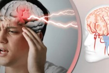 ‍ ۸۰ درصد از سکته‌های مغزی قابل پیشگیری‌اند