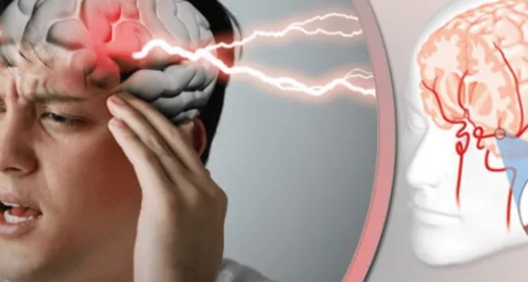 ‍ ۸۰ درصد از سکته‌های مغزی قابل پیشگیری‌اند