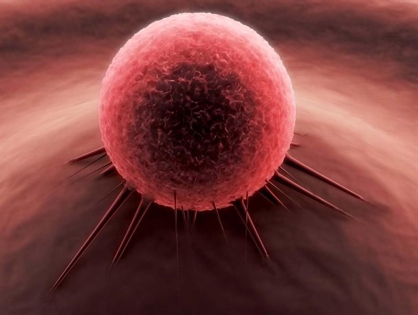 هجوم خاموش سونامی سرطان در ایران