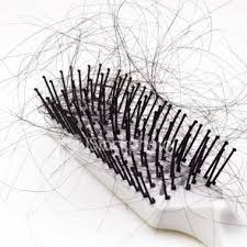  چرا موهای مردها می‌ریزد؟ 