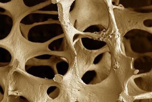 نگاهی به یک بیماری شایع میان بانوان کرمانشاهی/ تاثیر نور شفا بخش در پیشگیری از پوکی استخوان نگاهی به یک بیماری شایع میان بانوان کرمانشاهی/ تاثیر نور شفا بخش در پیشگیری از پوکی استخوان