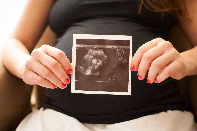  در بارداری چند بار سونوگرافی لازم است؟ 