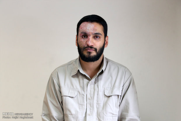 همه میتوانند شهید شوند/ هرکدام از زخمهای جانبازیام نشانه است همه میتوانند شهید شوند/ هرکدام از زخمهای جانبازیام نشانه است