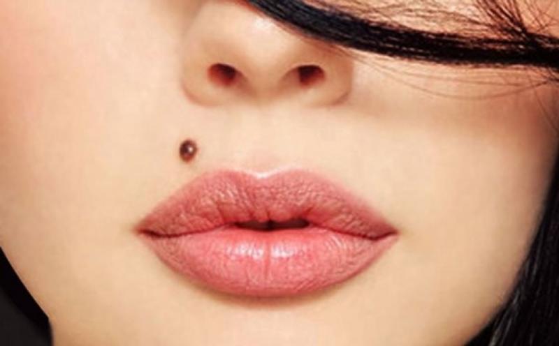  آیا همه خال ها برای نمونه برداری باید برداشته شوند؟ 