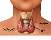  ارتباط بیماری تیروئید با ناباروری