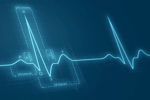 ۴۵ درصد مرگ ها در کرمانشاه به دلیل بیماری قلبی است