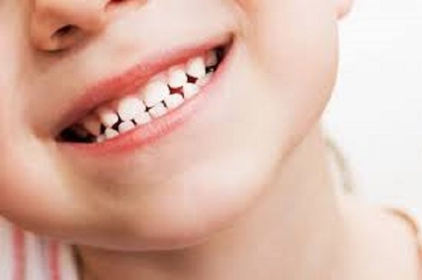 نکاتی که والدین باید در مورد دندان های شیری کودکان بدانند