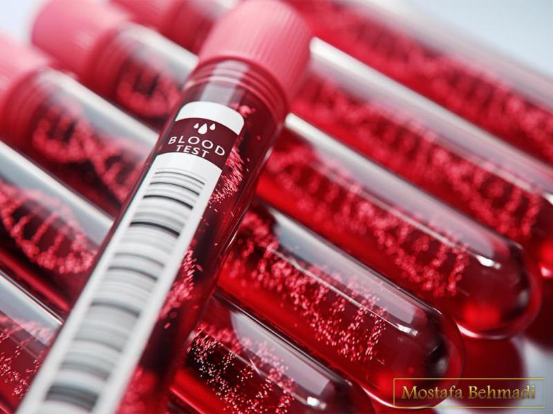 فاکتورهای پرخطر ابتلا به سرطان خون را بشناسید