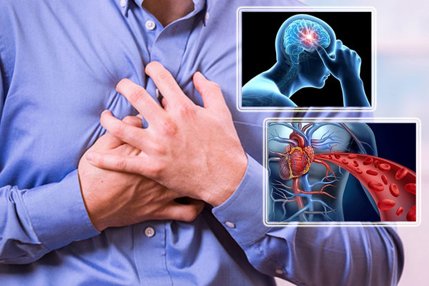 ۶۲ هزار مرگ سکته ای در سنین زیر ۷۰ سال کشور