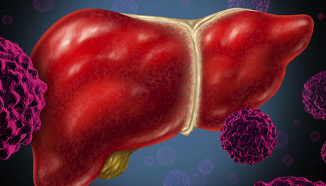  مراقب علائم هپاتیت باشید