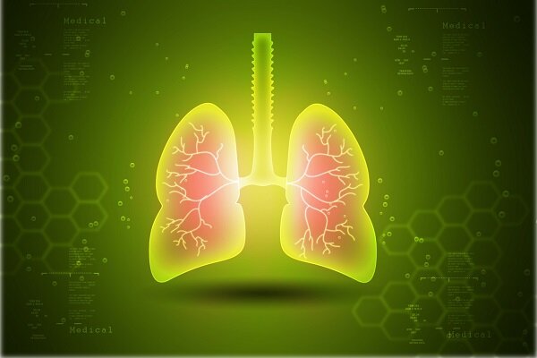 ارتباط عنصر کادمیوم با بروز عفونت شدید آنفلوانزا و ذات الریه ارتباط عنصر کادمیوم با بروز عفونت شدید آنفلوانزا و ذات الریه