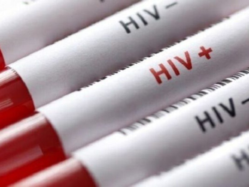 موفقیت ۹۷ درصدی درمان ایدز در کرمانشاه موفقیت ۹۷ درصدی درمان ایدز در کرمانشاه